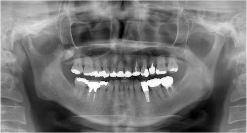河合８　上部構造装着後6ヶ月